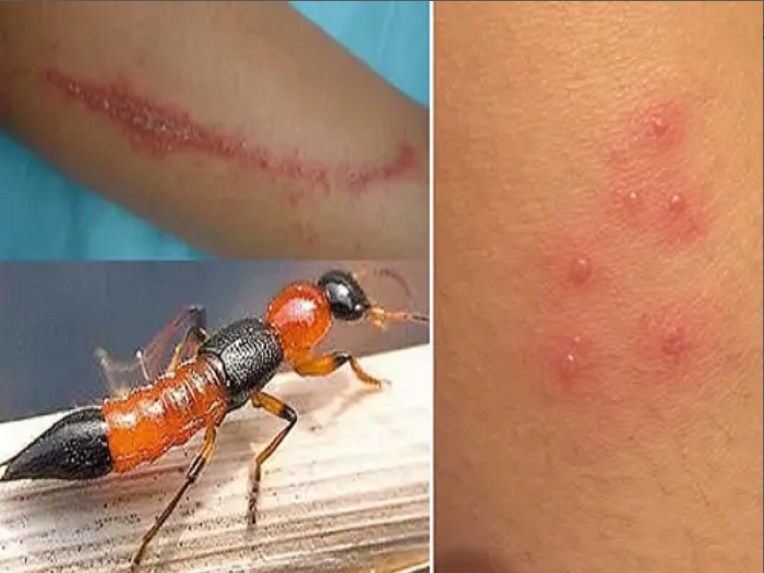 爬到身上千万别拍,它真的很毒 - 惠州科协